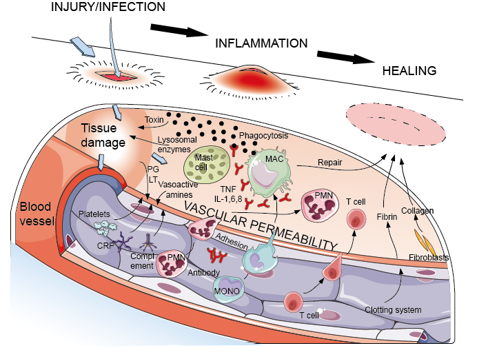 Acute Inflammation Creative Diagnostics